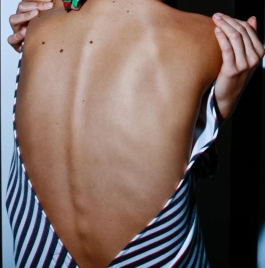 Photography. Close up. Model with a backless dress 